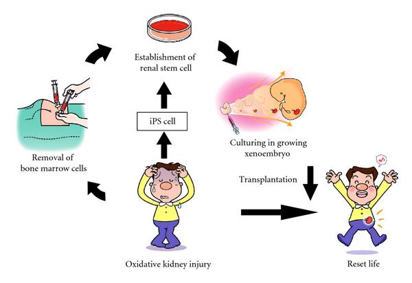 Managing Chronic Kidney Disease Upcoming Trends Witan World